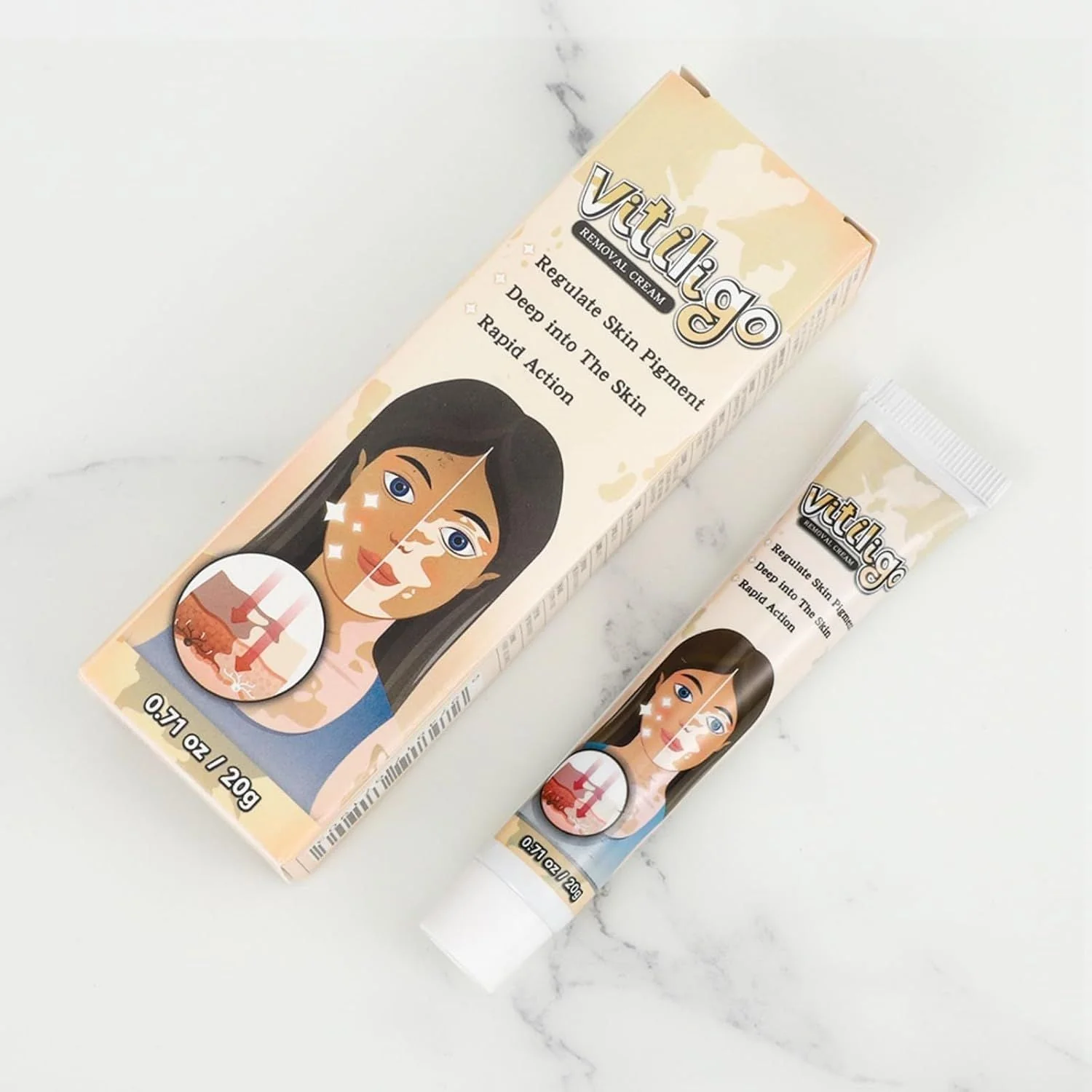Vitiligo Removal Cream