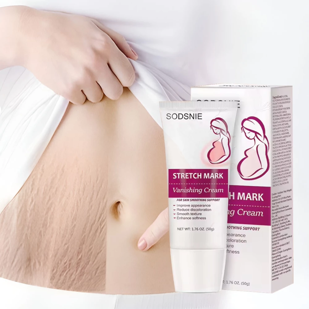 Stretch Mark Body Cream
