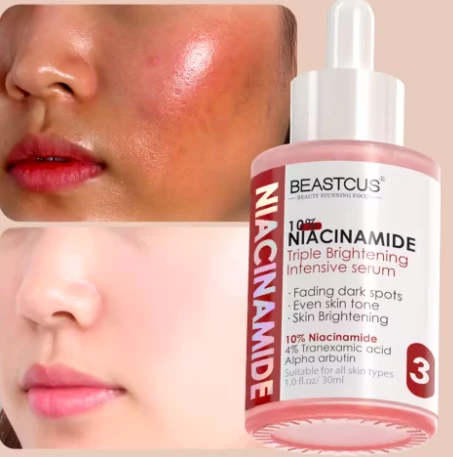 Beastcus 10% Niacinamide Brightening Serum