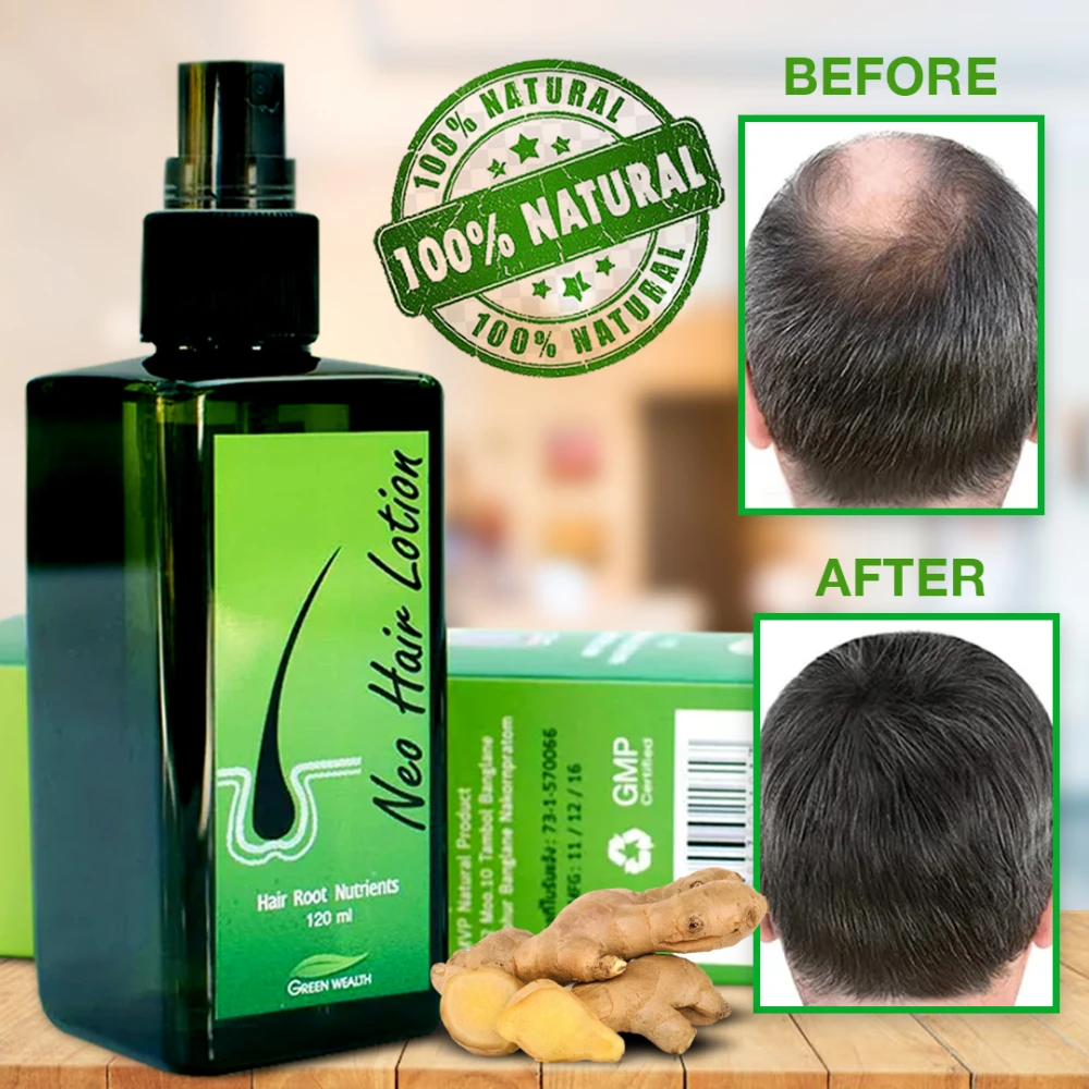 Green Wealth Neo Hair Lotion 120ml